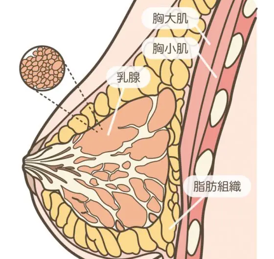 假體隆胸手感很假嗎